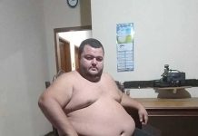 Arnaldo Segundinho precisa de ajuda para realizar cirurgia bariátrica