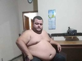 Arnaldo Segundinho precisa de ajuda para realizar cirurgia bariátrica