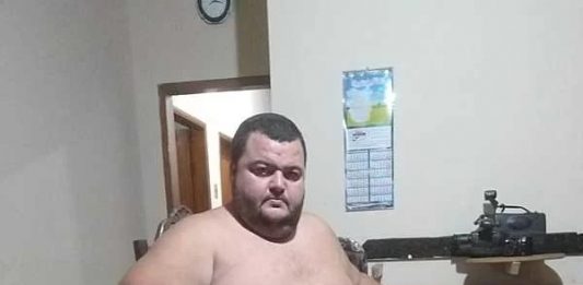 Arnaldo Segundinho precisa de ajuda para realizar cirurgia bariátrica