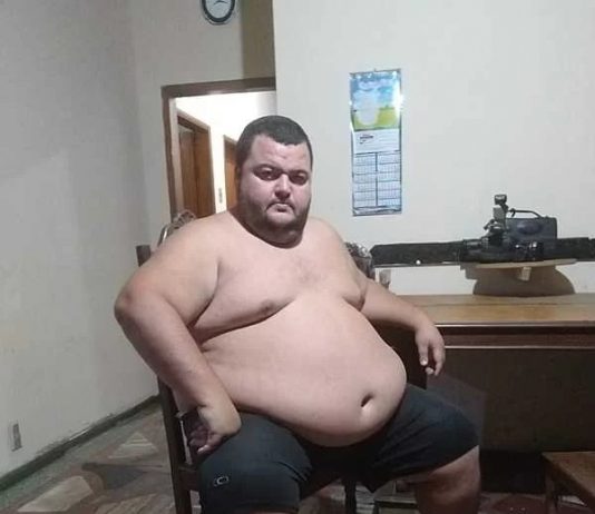 Arnaldo Segundinho precisa de ajuda para realizar cirurgia bariátrica