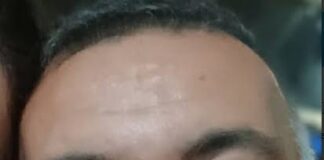 Lucas Marciel de Oliveira foi baleado durante uma emboscada
