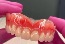 Fila por prótese dentária tem mais de 300 pessoas e espera chega em média a um ano