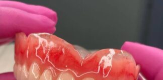 Fila por prótese dentária tem mais de 300 pessoas e espera chega em média a um ano